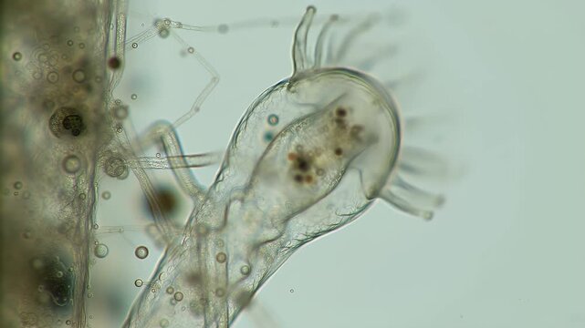 Detailed Microscopic View of Stentor Protozoa Attaching to a Substrate with Pellicle Cilia and Macronucleus Visible in Clear Fluid Environment for Scientific Study and Research Documentation