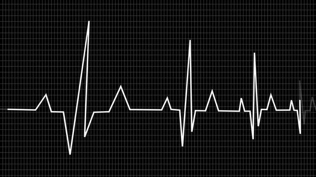 Cardiogram of heart beat Abstract Transparent Grid background. 4k Animated HUD Heart rate electrocardiogram medical monitor pulse of life. a striking minimalist visual of a heartbeat
