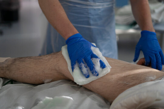 Nurse cleaning patient's leg with antiseptic solution before surgery