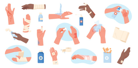 Injured hands set vector illustration. Cartoon isolated human arms with wounds and burn on body skin, cleaning and dressing with bandages, applying medical treatment for injury, first aid for trauma