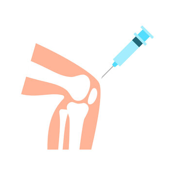 Knee injection for cartilage regeneration. New biomedical treatment for osteoarthritis and sports injuries. Collagen based gel to regrow joint cartilage. Regenerative medicine. Vector illustration.