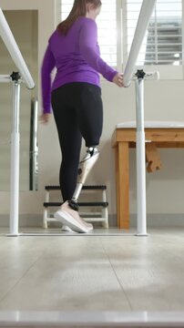 Vertical video: Gripping parallel bars, female patient walking with prosthetic leg in gym for rehab