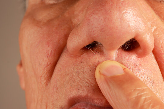 Man examine his wild nose hairs so he can pluck or trim them out
