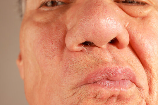 Man examine his wild nose hairs so he can pluck or trim them out