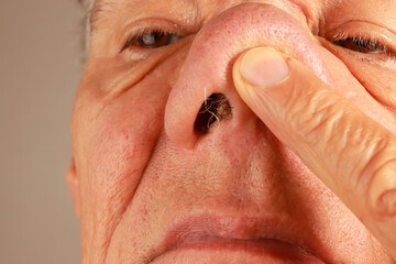 Man examine his wild nose hairs so he can pluck or trim them out