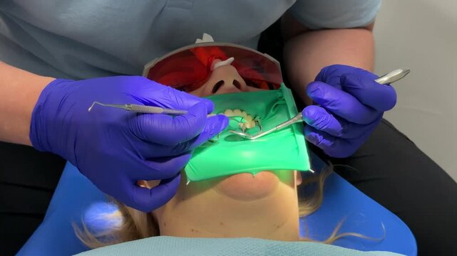 Dentist's hands in gloves with dental punch and cofferdam scarf. Dentist treats woman's tooth to patient with rubber dam. Modern dental office. Treatment elimination of caries, installation of filling