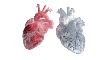 3D rendered hearts, one healthy, one diseased