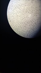 microscope, plant diseases