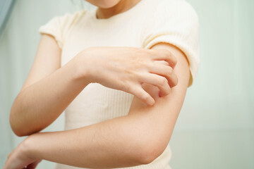 Asian woman itching of skin diseases using hand scratching.