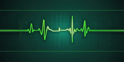 Healthy EKG heart pulse line on a medical monitor