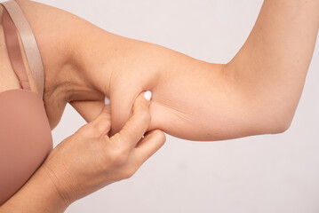Close-up of a mature woman's arm showing sagging skin. Perfect for themes of aging, cosmetic surgery, body acceptance, self-care, or health education visuals.