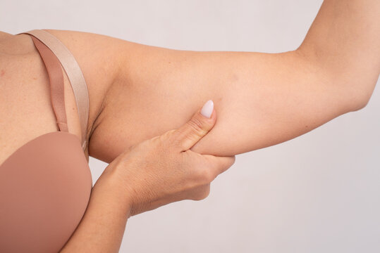 Realistic close-up of mature woman's arm with visible skin laxity. Useful for themes on aging, cosmetic surgery, body positivity, or medical education.