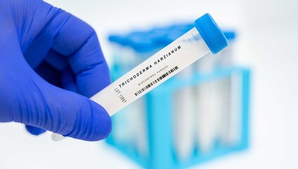Obraz premium Trichoderma harzianum