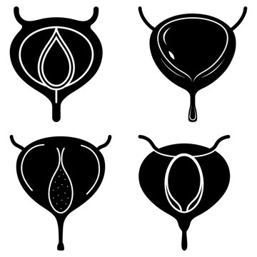Anatomical illustration showing bladder variations with different shapes and internal structures depicted in black