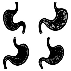 Fototapeta premium Four black and white stomach illustrations showing different internal structures and conditions of the organ