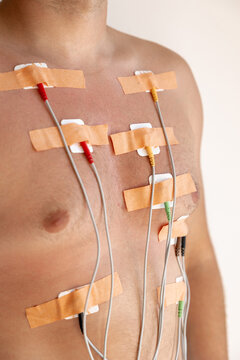 Man with medical electrodes on his chest for cardiac monitoring
