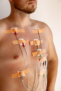 Man with medical electrodes on his chest for cardiac monitoring