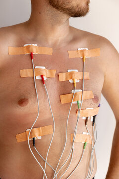 Man with medical electrodes on his chest for cardiac monitoring