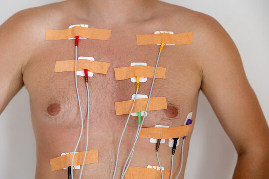 Man with medical electrodes on his chest for cardiac monitoring