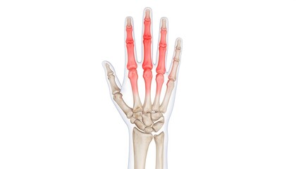 Anatomical illustration of a hand with highlighted joints