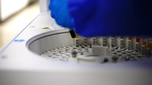 Close up of Test tubes with blood and urine getting inserted into a biochemical analyzer by a lab worker