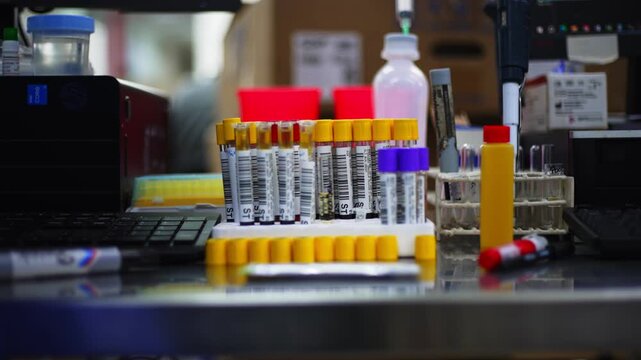 Close up view of Test tubes with blood samples in a lab.