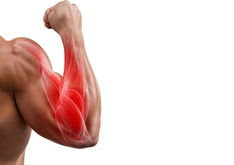 Inflamed Biceps Brachii (Turns slightly red). isolated on transparent or white background