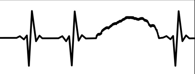 Fototapeta premium Electrocardiogram Waves - Barre des Ecrins