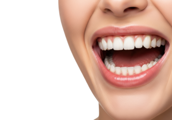 Young caucasian woman's mouth widely open in a joyful laugh, perfectly white teeth, healthy pink gums, glossy lips, transparent studio background with copy space, high-key lighting, dental health