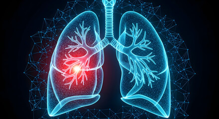 3D rendering of lungs with highlighted inflamed area.