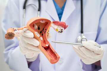 Uterus, doctor holding human anatomy model for study diagnosis and treatment in hospital.