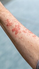 Close-Up of Skin Rash on Human Arm