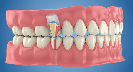 Obraz premium Detailed dental cross-section reveals tooth anatomy, pulp, and root canal system for educational and medical use