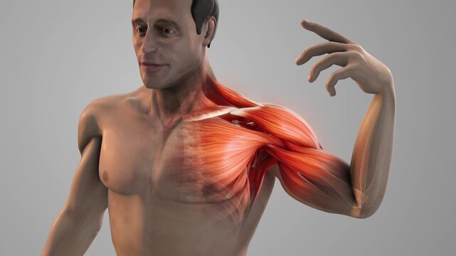 Shoulder Muscle Inflammation Causing Severe Joint Pain