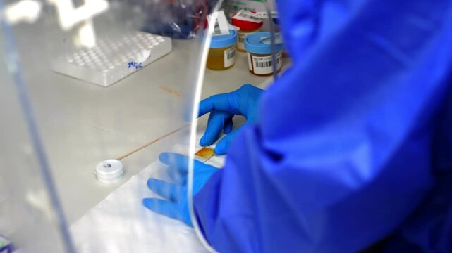 Close up view of a Scientist researching blood sample under microscope. Doctor is working in laboratory with blood DNA