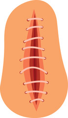 Stitches closing a wound after surgery, healing process of human skin