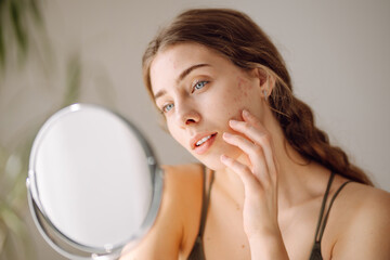 Close-up of a young woman's face with rashes looking into a small mirror in a cozy room. A beautiful woman examines red spots on her face. The concept of naturalness, dermatology, acne.