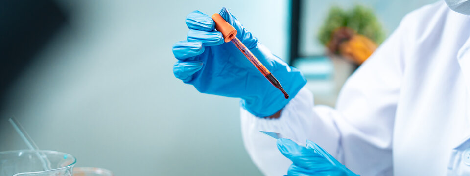 Close-up of a scientist in protective gloves placing a drop of blood on a glass slide for microscopic analysis, symbolizing healthcare diagnostics, medical research, and scientific precision.