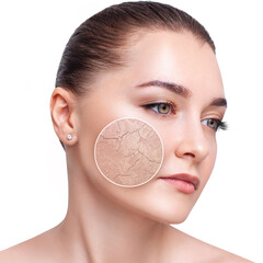 Young woman with zoom circle shows dry facial skin before moistening.