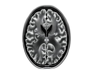 Cross sectional view of a realistic human brain in monochrome for medical study purposes