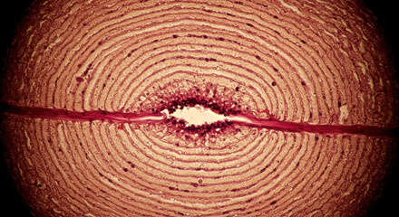 Microscopic Cross-Section of Bone Tissue: Concentric Layers and Central Canal