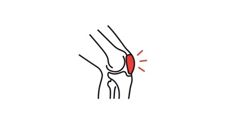 Stylized knee pain illustration, conveying discomfort or injury concept