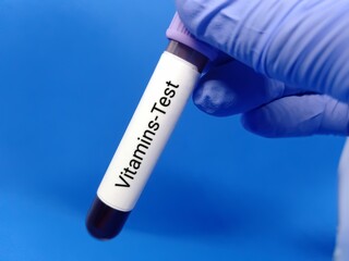 Obraz premium Doctor holding a test blood sample for Vitamins test. Laboratory medical testing concept. . 