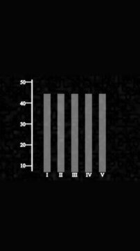 Animated business finance chart data visualization abstract motion graphics vertical video. Animated data visualization chart abstract background Roman numerals motion graphics vertical video.