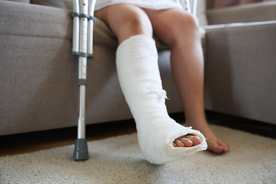 girl with a broken leg in a cast and bandage sits on a sofa metal crutches with height adjustment are at her feet sore leg in focus healthy leg out of focus - Powered by Adobe