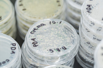 Petri dishes with microbial cultures in science laboratory