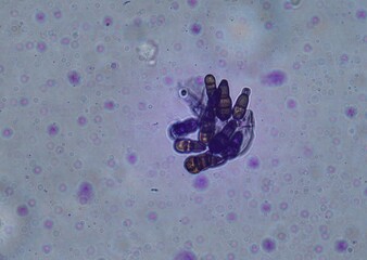 soil microorganisms under a microscope including amoeba, flagellates, nematodes, fungi, bacteria	