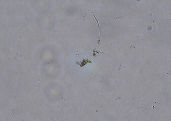 soil microorganisms under a microscope including amoeba, flagellates, nematodes, fungi, bacteria	