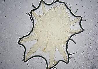 soil microorganisms under a microscope including amoeba, flagellates, nematodes, fungi, bacteria	