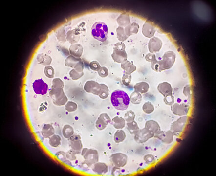 Neutrophils is a kinds of WBC or white blood cells analysis with light microscope.